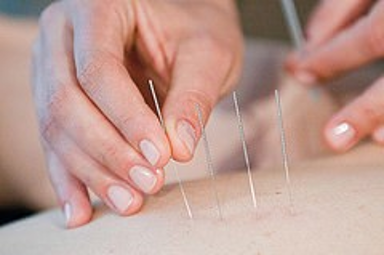 medicare covers acupuncture